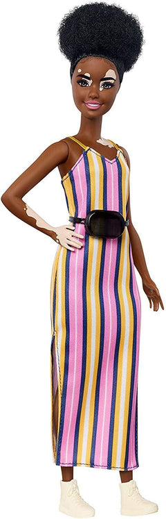 Barbie Fashionista Vitiligo Doll
